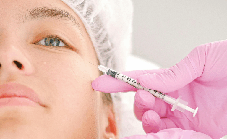 Bolsa nos olhos após botox