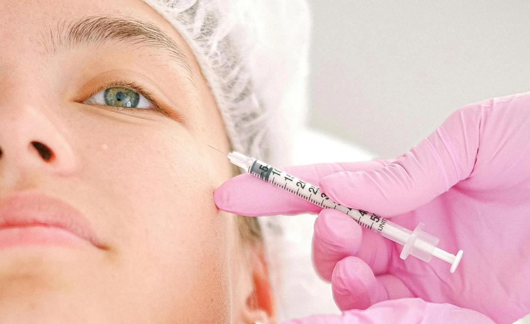 Bolsa nos olhos após botox